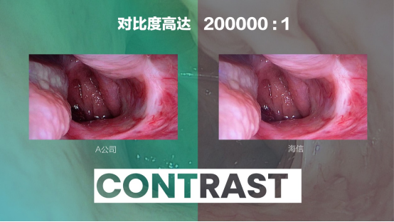 07 海信發布全球首臺55吋Mini-LED醫用內窺顯示器365.png