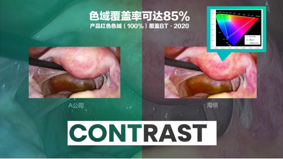 07 海信發布全球首臺55吋Mini-LED醫用內窺顯示器631.png